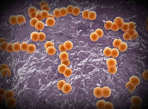 6 Dead amid Meningococcal Disease Outbreak Affecting Gay, Bisexual Men