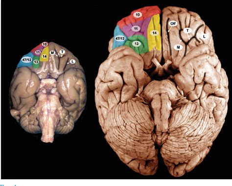 Figure 2 from Orbitofrontal cortex and its contribution to decision-making. | Semantic Scholar