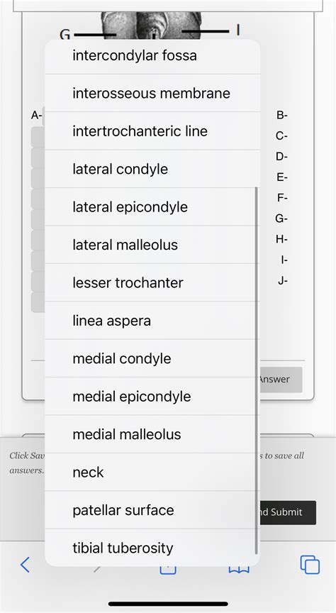 Solved Question Completion Status: G adductor tubercle fovea | Chegg.com