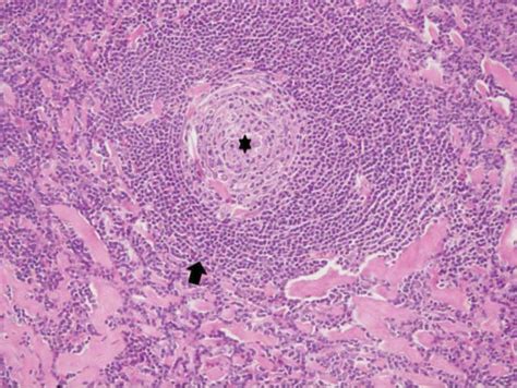 Regressed germinal center comprising only of follicular dendritic cells... | Download Scientific ...