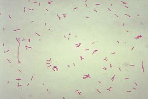 Bacteroides Gram Stain