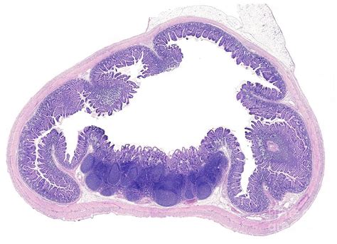 Peyer's Patches Histology Offers Online | brunofuga.adv.br