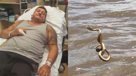 Darwin man delays getting sea snake bite treated to go fishing and ...