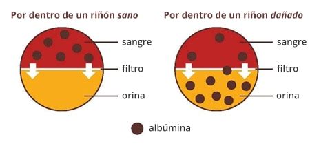 Insuficiencia Renal - Mind Map