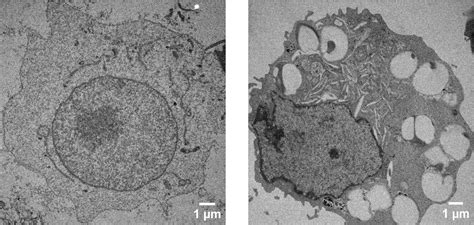 DNA attached to nanoparticles found to contribute to lupus symptoms