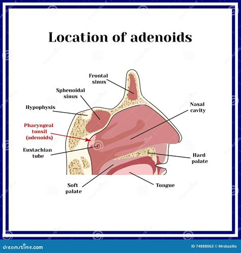 Location of Adenoids.the Structure of the Nasopharynx Stock Vector - Illustration of eustachian ...