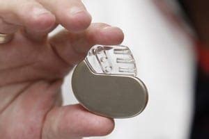 FDA Warns of Medtronic’s Pacemakers With Defective Batteries