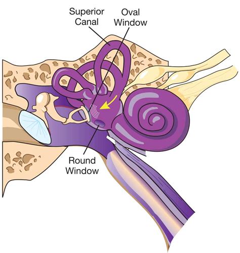 Perilymph Fistula | Ears & Diving - DAN Health & Diving