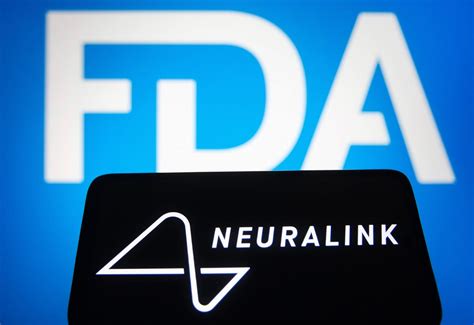 Elon Musk’s Neuralink Brain Implant Could Begin Human Trials In 2023