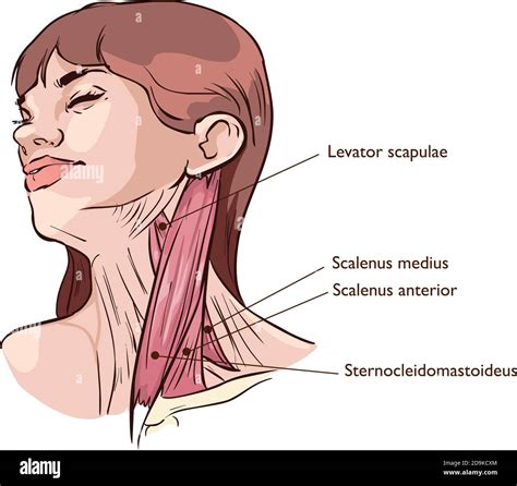 Vector illustration of Neck muscles anatomy Stock Vector Image & Art ...