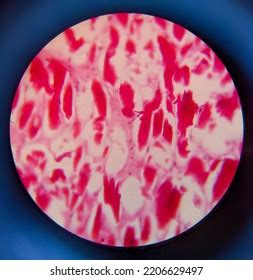 Photo Adipose Tissue Under Microscope Stock Photo 2206629497 | Shutterstock