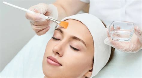 The Surprising Benefits of a Chemical Peel for Healthier Skin