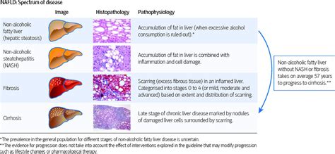 Researchers have made a discovery about how disease pathogenesis in the ...