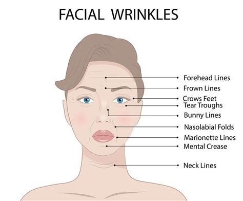 16 Popular Botox Injection Areas for Face and Neck Wrinkles - Pharmacy ...