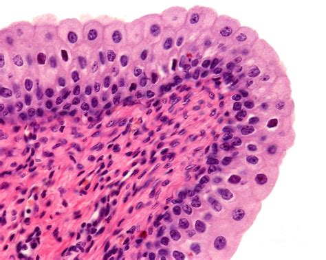 Urinary Bladder Transitional Epithelium Photograph by Jose Calvo / Science Photo Library - Fine ...