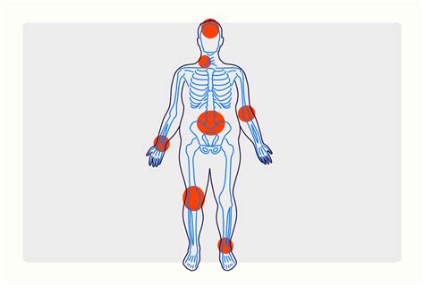 Chronic Pain: Symptoms, Causes, and Treatment