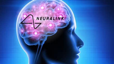 Neuralink Received The Go Signal For Human Study