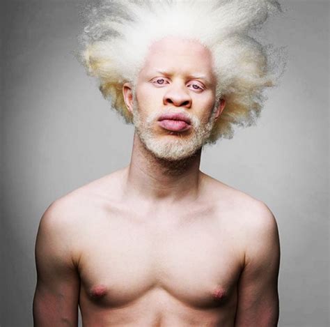 14 Models With Albinism Who Are Taking The Fashion World By Storm - Beastly