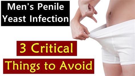 Men's Penile Yeast Infection - 3 Critical Things to Avoid - YouTube