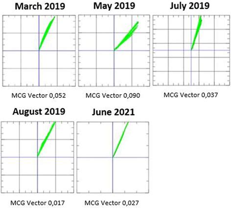 Magnetocardiography (MCG) measurements from March 2019 to June 2021 ...