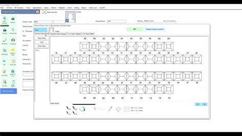 Periodontal Charting Software Tutorial