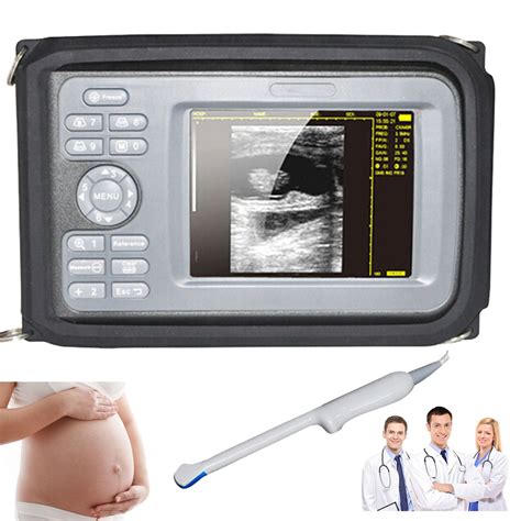 Digital Portable Handheld Ultrasound Scanner Machine+Transvaginal Prob – DIAGNOSTIC ULTRASOUND ...