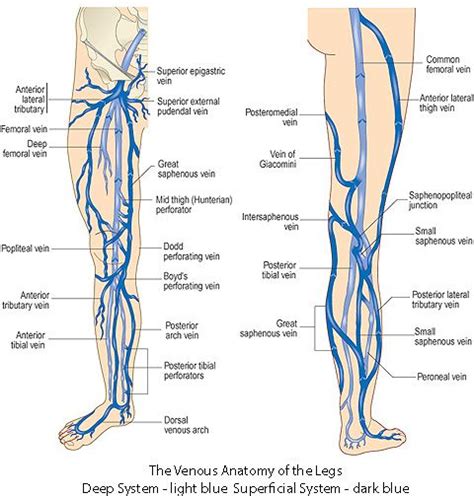 Leg veins, Anatomy, Varicose vein surgery