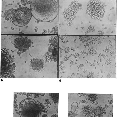 (B) HIV-1-and HIV-2-induced syncytia formation in PBMCs. Syncytia... | Download Scientific Diagram