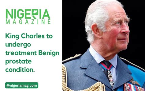 King Charles to undergo treatment of Benign prostate condition | NigeriaMag