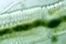 Annelida: Stylaria lacustris