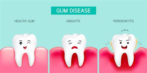 Four Unexpected Consequences of Untreated Gum Disease - Dr. Matt