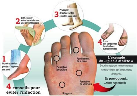 Pin on Santé (Health)