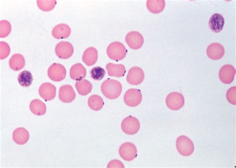 Haemobartonella Canis