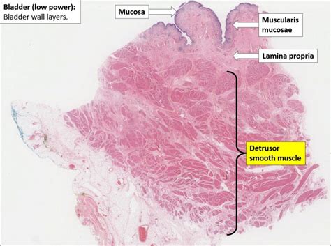 Bladder – Normal Histology – NUS Pathweb :: NUS Pathweb