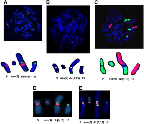 FISH analysis. The chromosomes involved in the... | Download Scientific ...