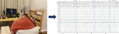 Schematic representation of the EEG recording process. | Download ...