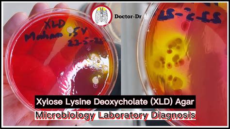 Principle Of Xylose Lysine Deoxycholate Agar (XLD Agar) II, 46% OFF