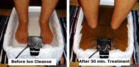 Ionic Detox Footbath - Biotherapy