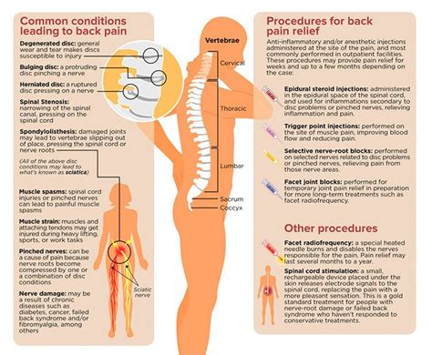 Lower Back Pain Diagnosis Chart