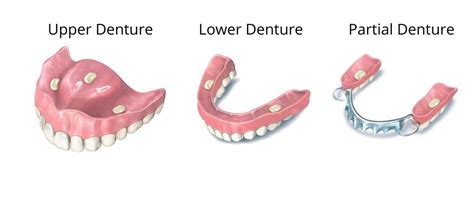 Polident Denture Adhesive | Haleon HealthPartner