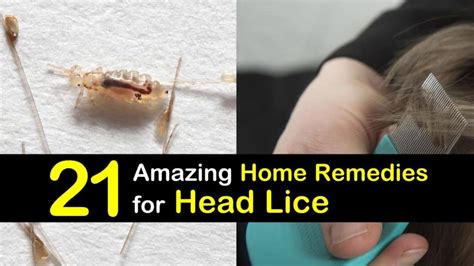 21 Natural Remedies for Head Lice