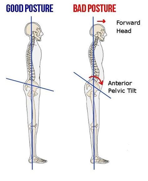 Hard Flaccid, Premature Ejaculation, ED due to Posture? +An Inability to RK : r/erectiledysfunction