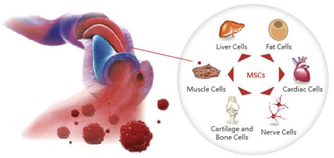 Cord Blood Banking: Definition, Use, Pros and Cons to Know