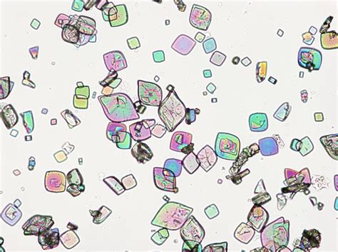 Uric Acid Crystals Polarized Light | ubicaciondepersonas.cdmx.gob.mx