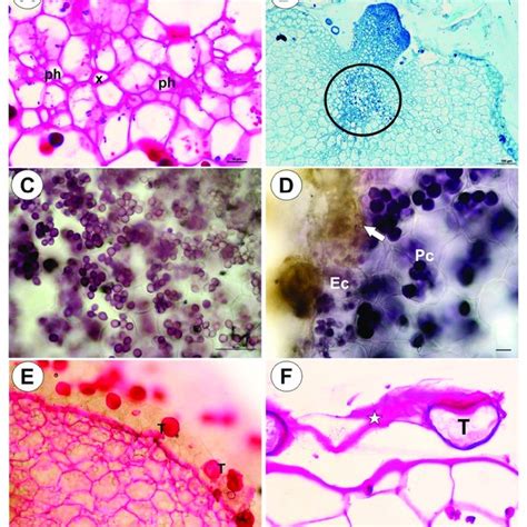 Tuber and stolon structure of Utricularia mannii. A. Chloroplasts in... | Download Scientific ...