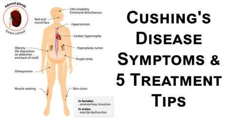 Cushing's Disease Symptoms & 5 Treatment Tips - David Avocado Wolfe