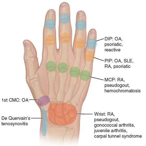 Interphalangeal Joint Thumb submited images | Pic2Fly