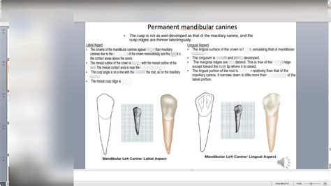 mandibular canines Diagram | Quizlet