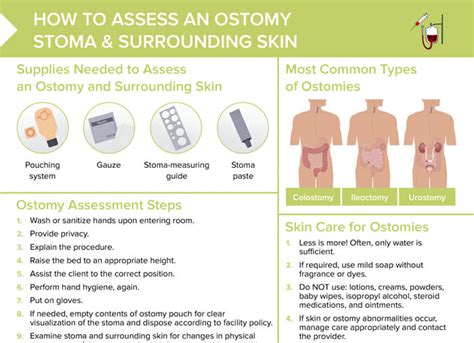 Changing Colostomy Bag Procedure