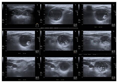 Thyroid Ultrasound | Carreras Medical Center